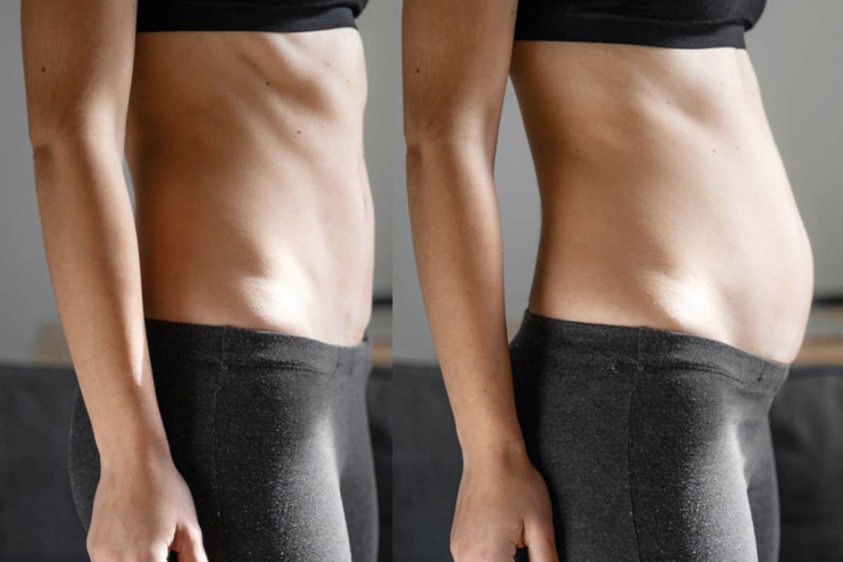 How long does diastasis recti take to improve Bellshill?
