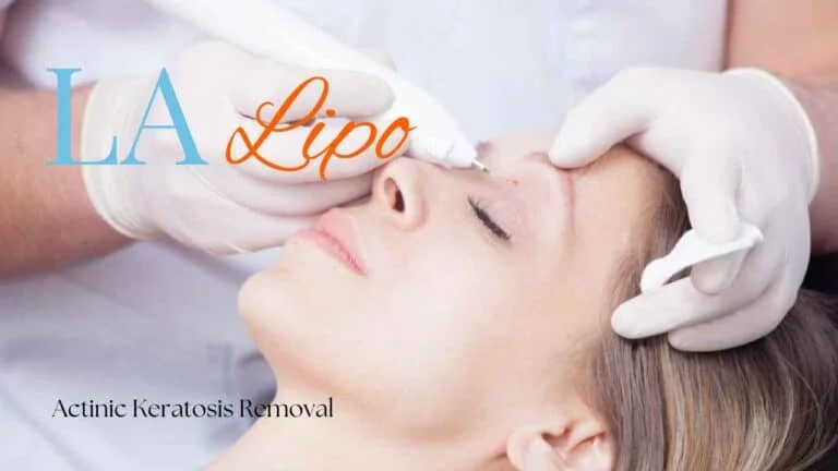 Woman receiving Actinic Keratosis Removal Treatment Bellshill
