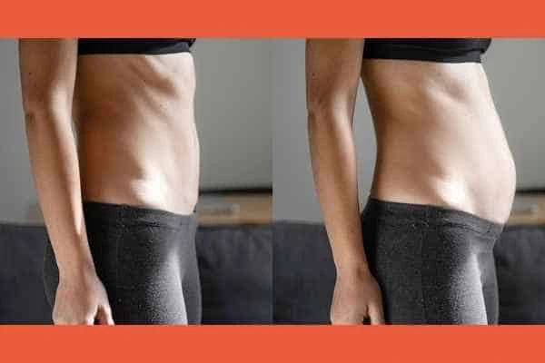 LA-EMS Body Sculpting results Bellshill