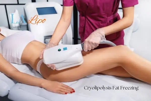 Woman receiving coolsculpting Bellshill treatment on her thighs