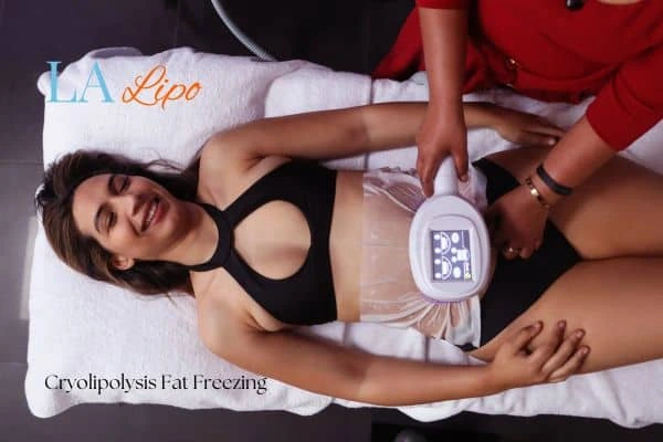 woman getting cryolipolysis Bellshill
