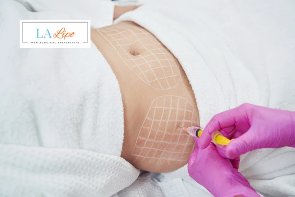 aqualyx fat dissolving injections Bellshill