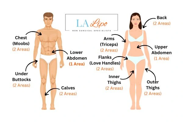 LA LIPO Cryolipolysis Areas Bellshill
