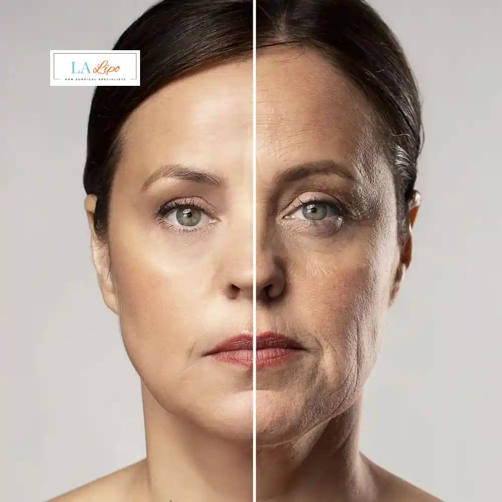 How Can You Tell If Non-Surgical Skin Tightening Is Right for You Bellshill?
