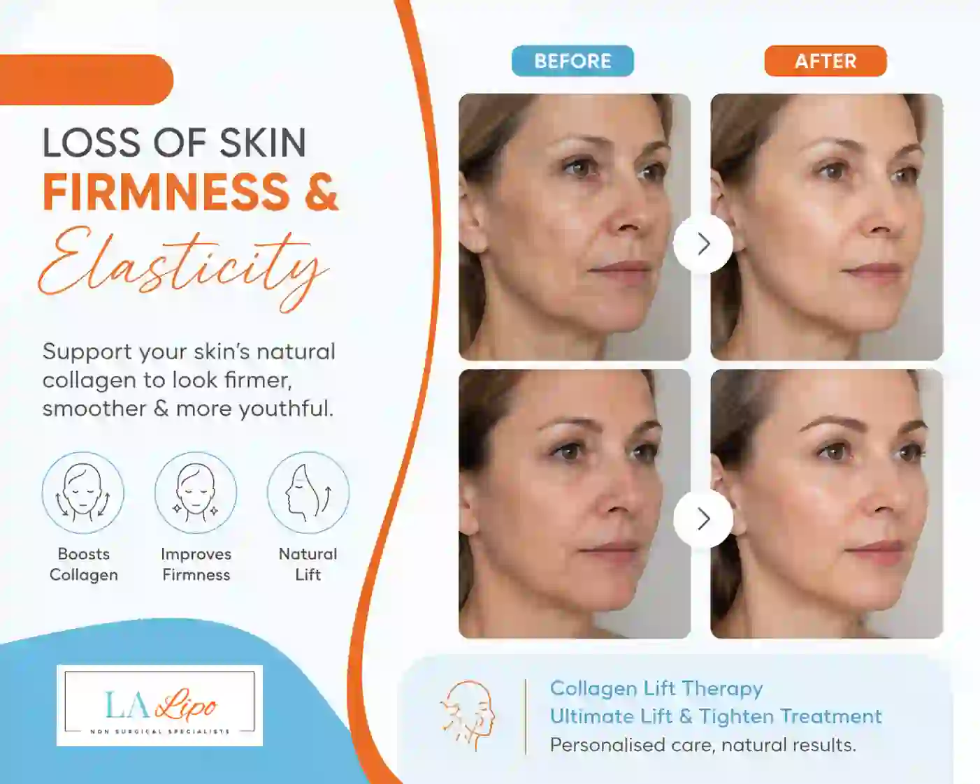 Sign #7: Loss of Skin Firmness and Elasticity Bellshill